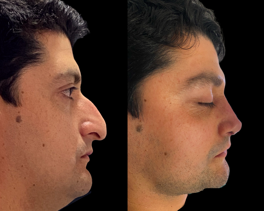 Caso 2: Antes y Después